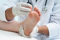 Treatment of Athlete’s Foot