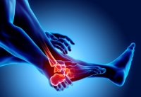 Causes and Symptoms of Ankle Arthritis