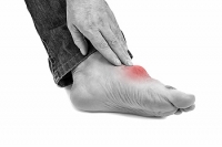 Risk Factors for Getting Gout
