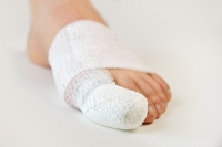 Four Categories of Broken Toes
